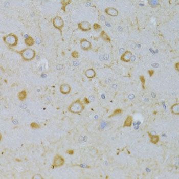 Immunohistochemistry - TSHR Polyclonal Antibody (144-06781)