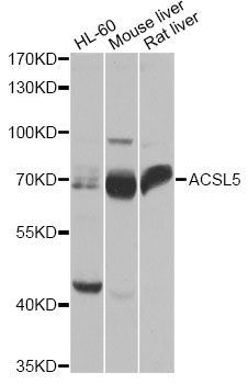 Western blot - ACSL5 antibody (144-60588)
