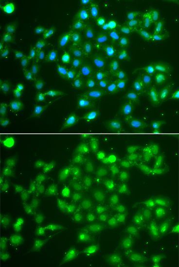 Immunofluorescence - UCHL5 Polyclonal Antibody (144-07978)
