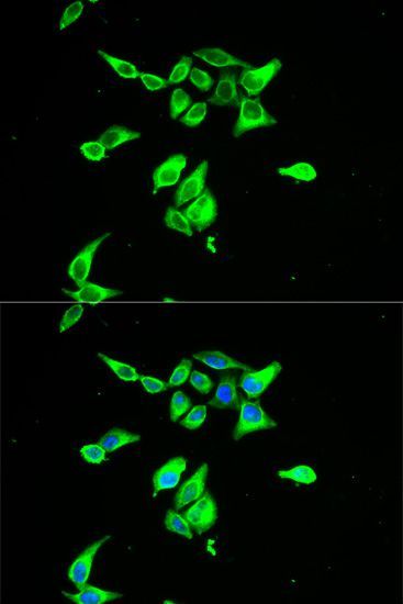 Immunofluorescence - CD55 antibody (144-01228)