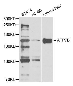 Western blot - ATP7B antibody (144-05676)