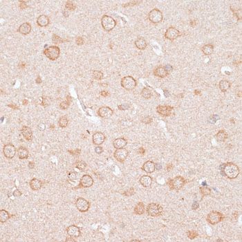 Immunohistochemistry - KCNJ4 antibody (144-014010)