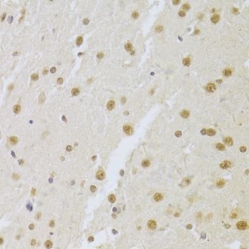 Immunohistochemistry - SNRPA Antibody (144-06410)