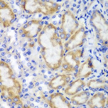 Immunohistochemistry - HCLS1 antibody (144-02165)