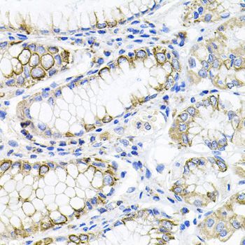 Immunohistochemistry - ACVR2A Polyclonal Antibody (144-01981)