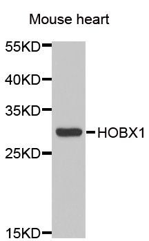 Western blot - HOXB1 Polyclonal Antibody (144-06619)