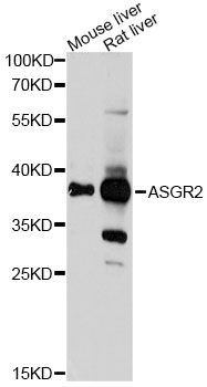 Western blot - ASGR2 Antibody (144-60531)