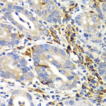 Immunohistochemistry - AIMP1 antibody (144-05301)