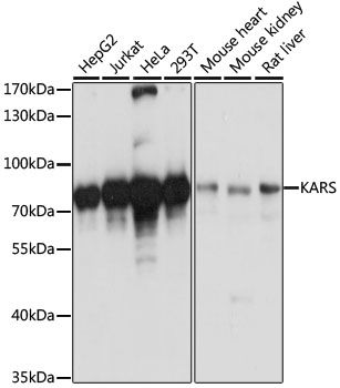 Western blot - KARS antibody (144-013772)