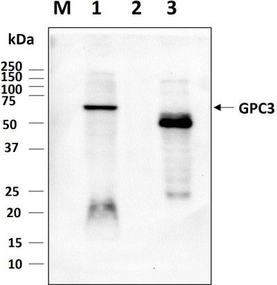 Western blot