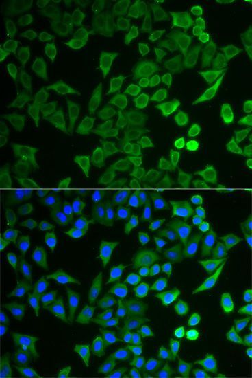 Immunofluorescence - NPRL2 antibody (144-05859)