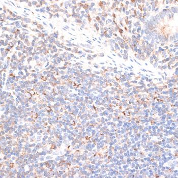 Immunohistochemistry - KIF14 Polyclonal Antibody (144-10275)