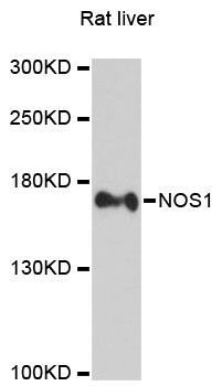 Western blot - NOS1 antibody (144-01485)