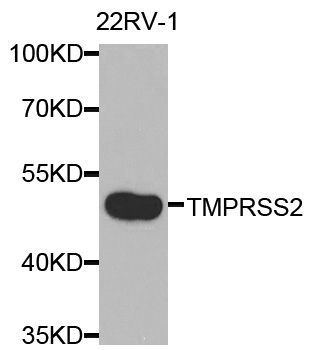 Western blot - TMPRSS2 antibody (144-01979)