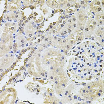 Immunohistochemistry - PLK4 antibody (144-09863)