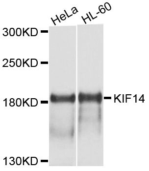 Western blot - KIF14 Polyclonal Antibody (144-10275)