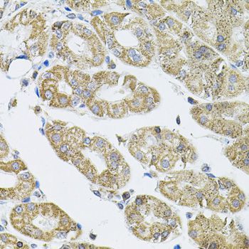 Immunohistochemistry - VEPH1 antibody (144-08510)