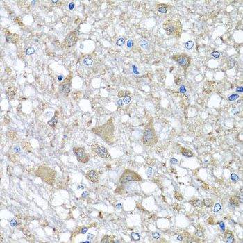 Immunohistochemistry - VPS37A antibody (144-07853)