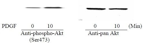 AKT (S473) - Western Blot