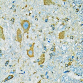 Immunohistochemistry - RPS7 Polyclonal Antibody (144-06731)