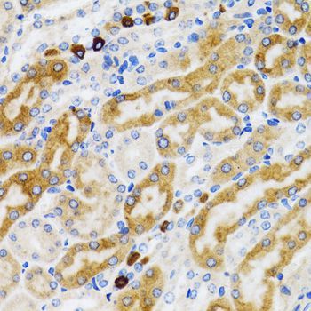 Immunohistochemistry - PGRMC1 antibody (144-05619)