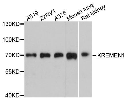 Western blot - KREMEN1 Polyclonal Antibody (144-600567)