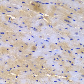 Immunohistochemistry - SGCE antibody (144-05330)