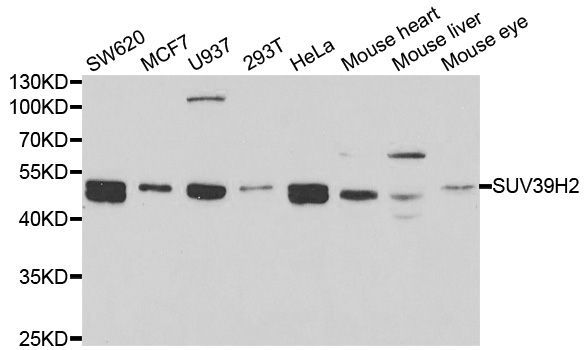 Western blot - SUV39H2 Polyclonal Antibody (144-05855)