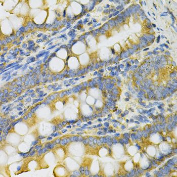 Immunohistochemistry - PGK1 Antibody (144-60560)