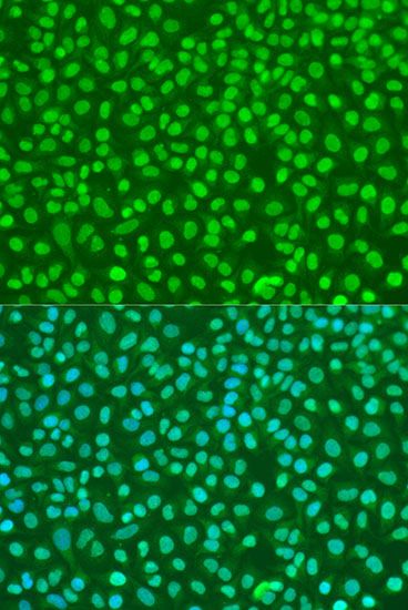 Immunofluorescence - NBN antibody (144-07703)