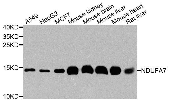 Western blot - [KO Validated] NDUFA7 Polyclonal Antibody (144-08441)