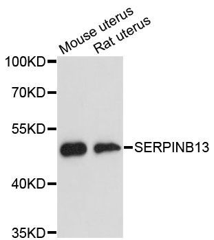 Western blot - SERPINB13 antibody (144-60469)