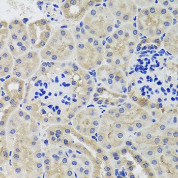 Immunohistochemistry - HK3 antibody (144-08428)