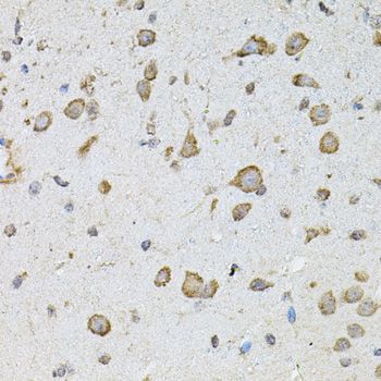 Immunohistochemistry - CHRFAM7A antibody (144-07844)