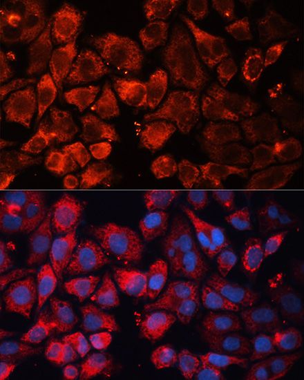Immunofluorescence - CASP3 Polyclonal Antibody (144-02156)