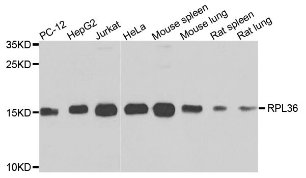 Western blot - RPL36 Polyclonal Antibody (144-07793)