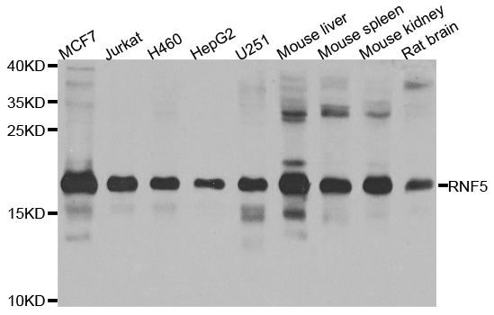 Western blot - RNF5 antibody (144-08351)