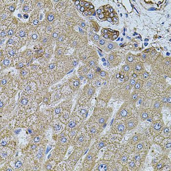 Immunohistochemistry - FLNB Polyclonal Antibody (144-02481)