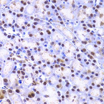 Immunohistochemistry - XRCC4 Polyclonal Antibody (144-01677)