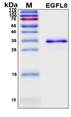SDS-PAGE Image