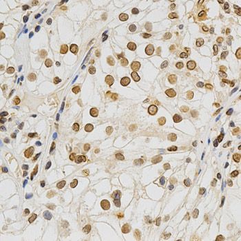 Immunohistochemistry - Lamin A/C Polyclonal Antibody (144-00249)