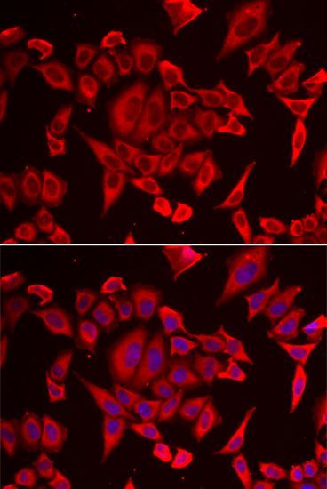 Immunofluorescence - SLC20A2 antibody (144-06739)