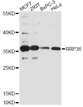 Western blot - RRP36 antibody (144-60639)