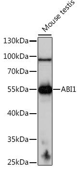 Western blot