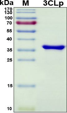 SDS-PAGE