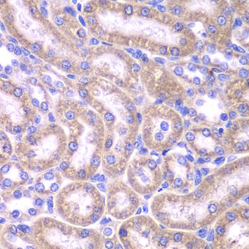 Immunohistochemistry - FADD antibody (144-05819)