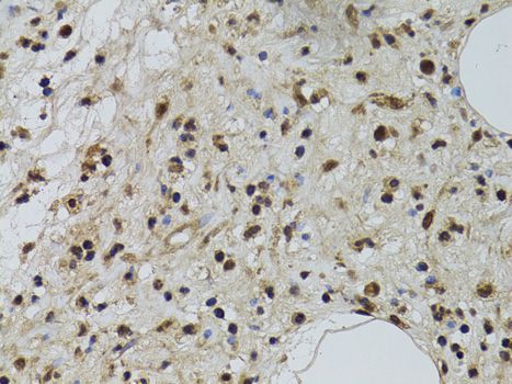 Immunohistochemistry - DCK antibody (144-01794)