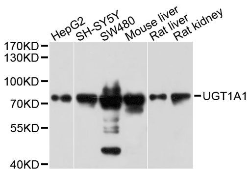 Western blot - UGT1A1 antibody (144-01359)