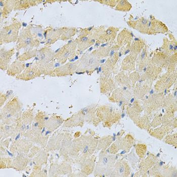Immunohistochemistry - PPA1 Antibody (144-02108)