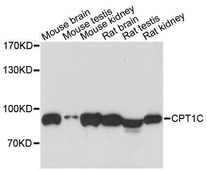 Western blot - CPT1C antibody (144-60498)